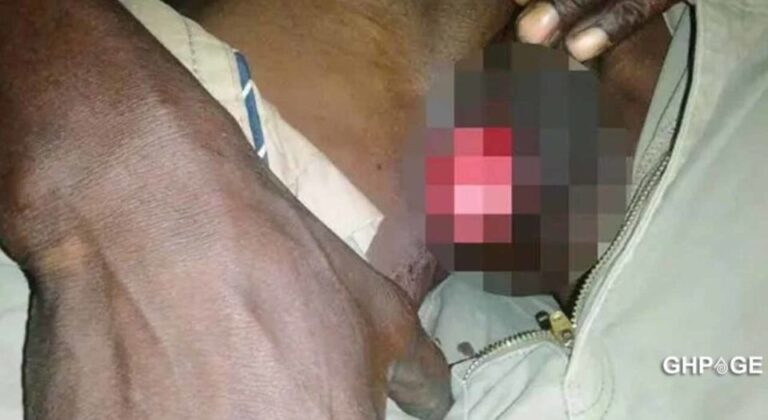 wife bites husband manhood 1068x584 1 960x525 1